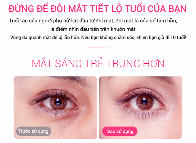 Hiệu quả sau khi dùng máy massage mắt của Bimix tích hợp công nghệ RF EMS giảm quầng thâm và bọng mắt