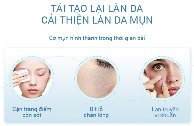 Máy rửa mặt Bimix BM606 sẽ giúp bạn loại bỏ mụn được hình thành do nhiều nguyên nhân hàng ngày