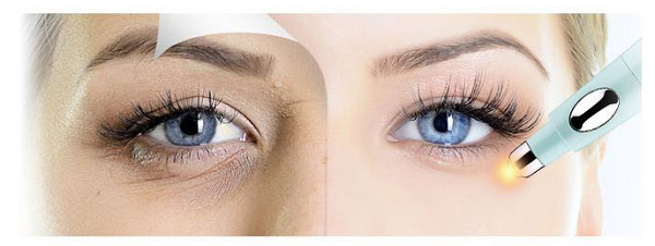 Thiết kế đầu giọt nước hỗ trợ cải thiện quầng thâm