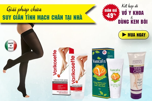 Giải pháp chữa suy giãn tĩnh mạch chân ngay tại nhà không cần dùng thuốc