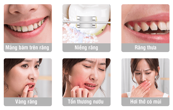 Sản phẩm sử dụng cho mọi lứa tuổi, giúp bảo vệ răng miệng một cách toàn diện